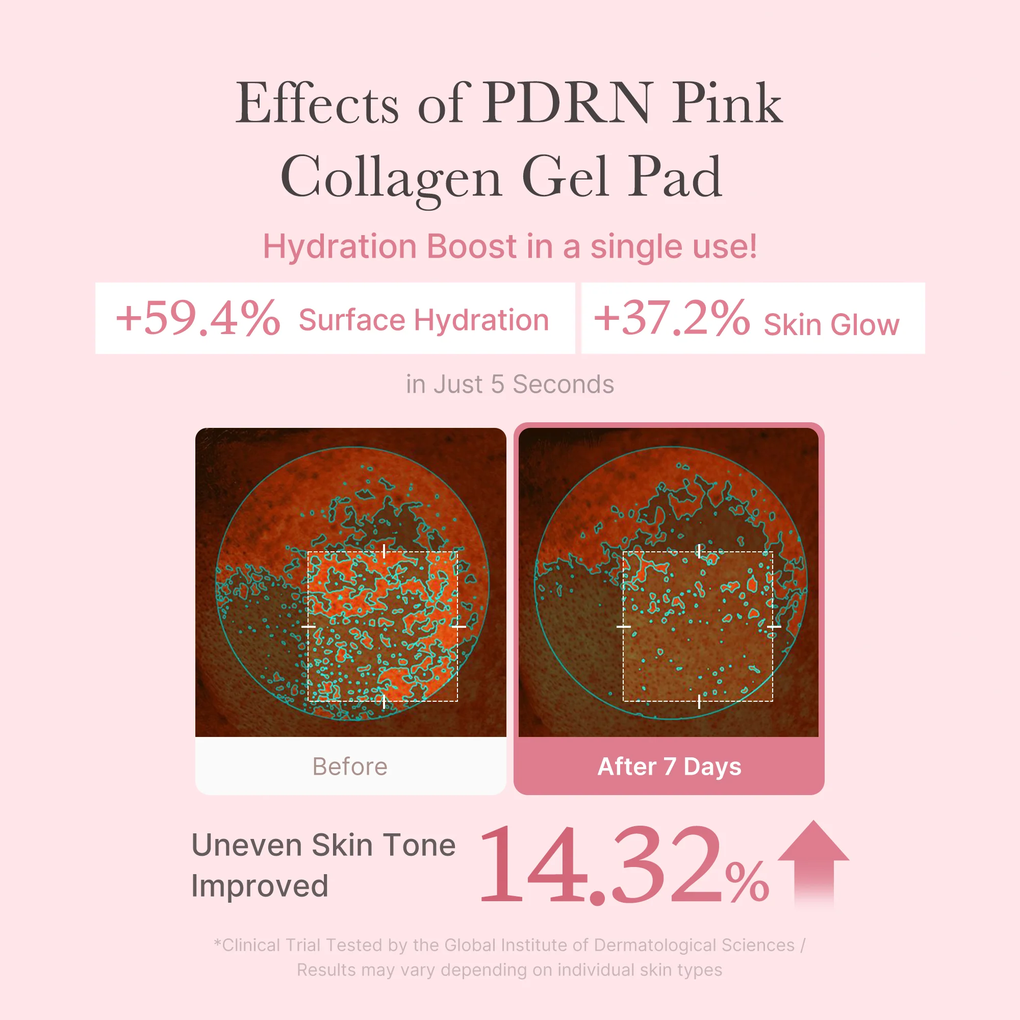 [Subscr.] PDRN Pink Collagen Gel Toner Pad - Image 5